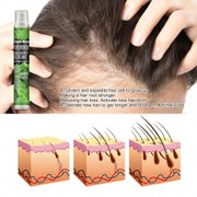 South Moon Hair Growth Serums, Hair Anti-Drop Liquid Hairline Thick Hair Herbal Essential Oil
