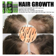 South Moon Hair Growth Serums, Hair Anti-Drop Liquid Hairline Thick Hair Herbal Essential Oil